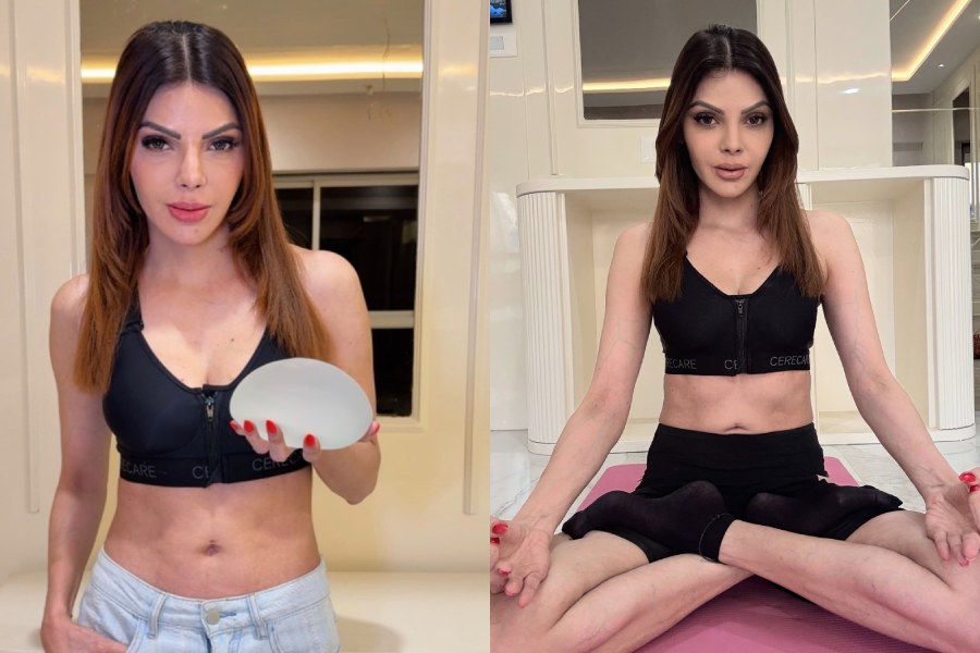 sherlyn chopra breast surgery