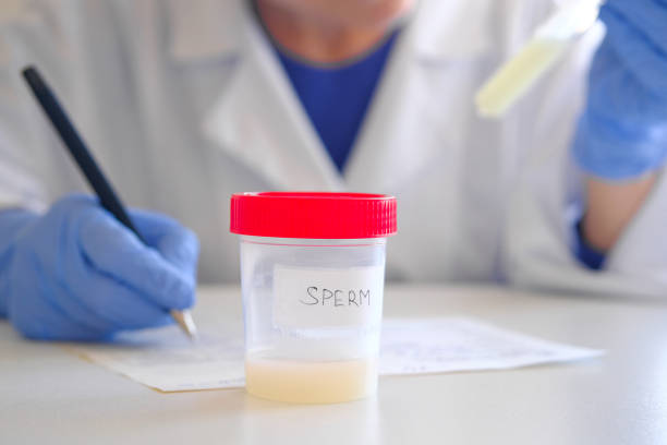 Male Infertility Causes